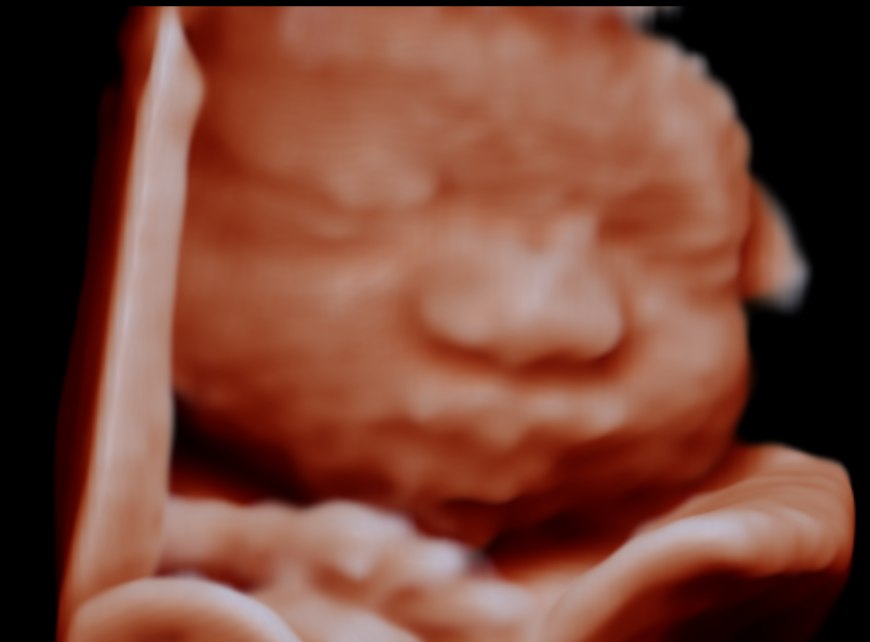 A 3D/4D ultrasound portrait of a baby's face at Hello Baby