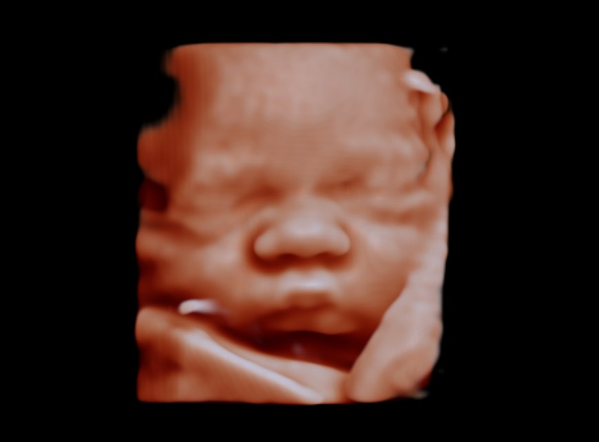 A 3D/4D ultrasound portrait of a baby's face at Hello Baby
